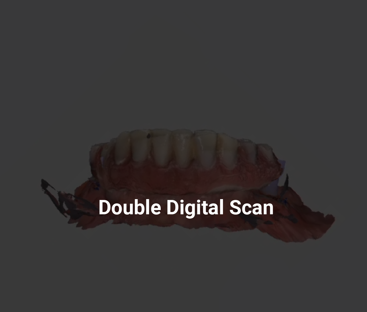 05 Alignment on medit design app