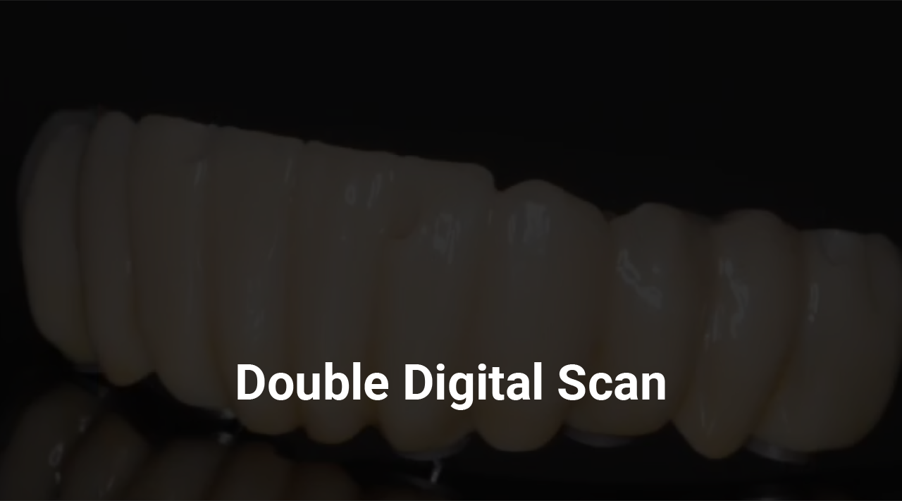 07 Clinical strps Try In and deliver the full arch fixed screw retained monolithic Zr bridge