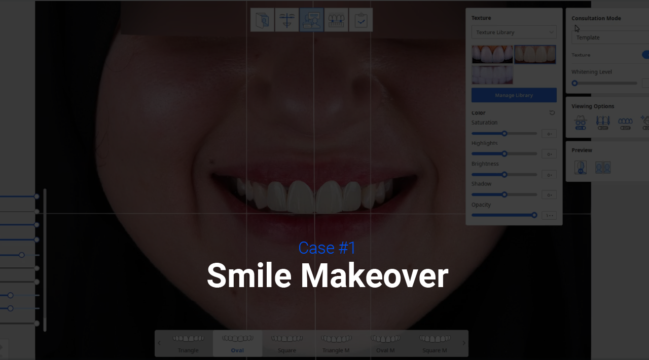 01 Case 1_Smile Design