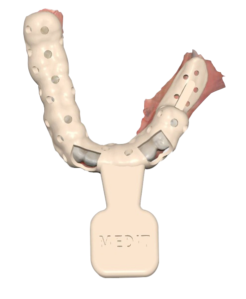 Medit - Individual Tray Design